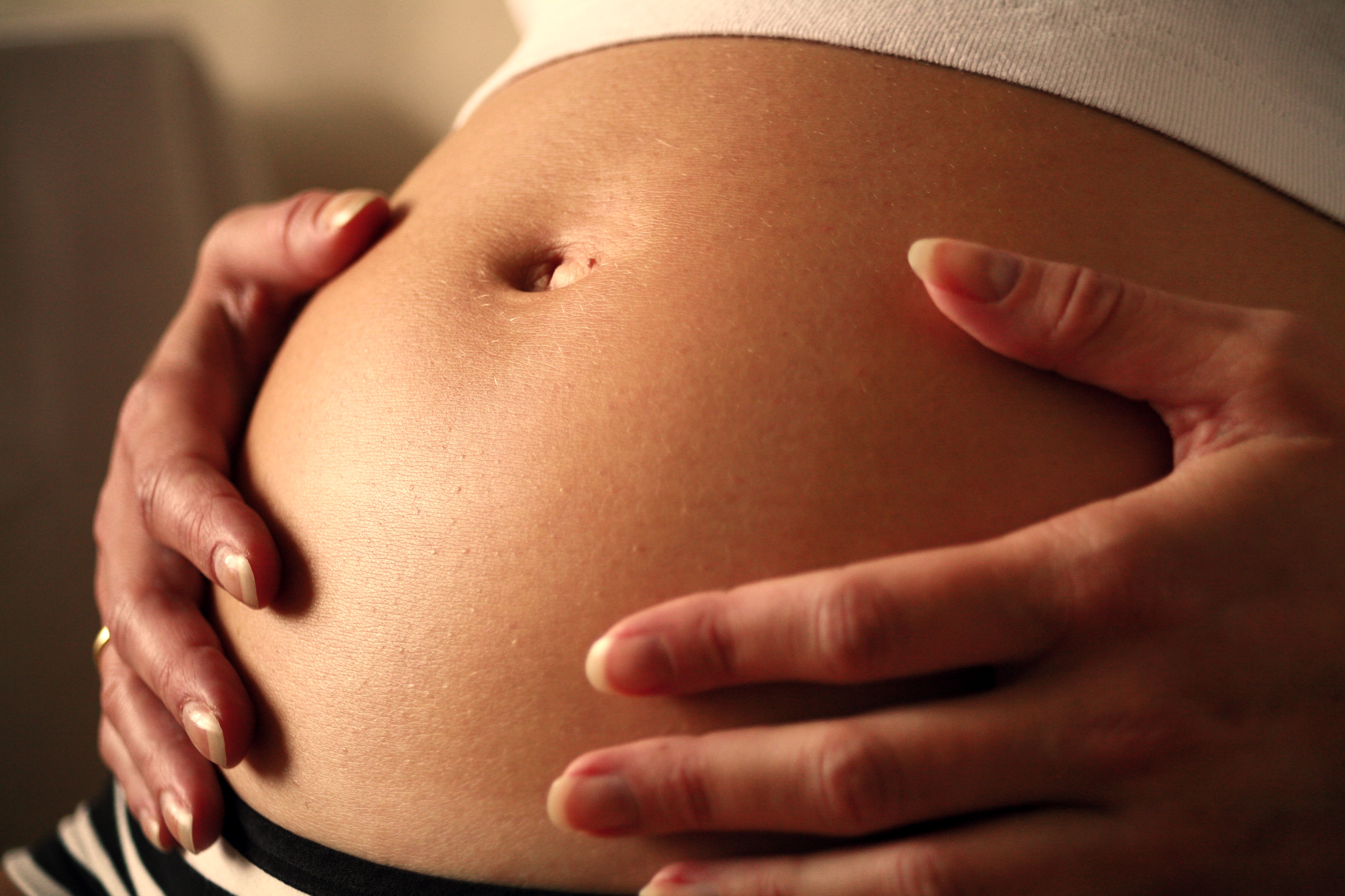 What Moms Should Know About Stretch Marks
